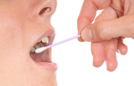 Mouth Swab