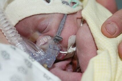oxygen premature baby