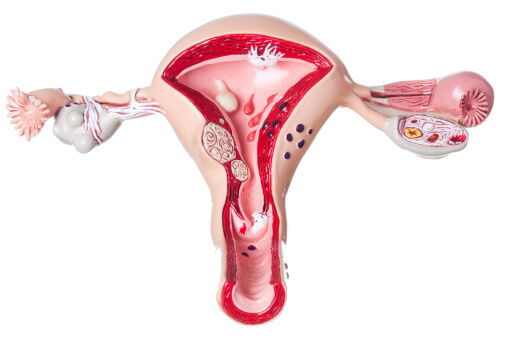 Uterus and ovaries