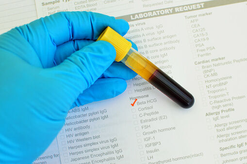 Beta HCG testing