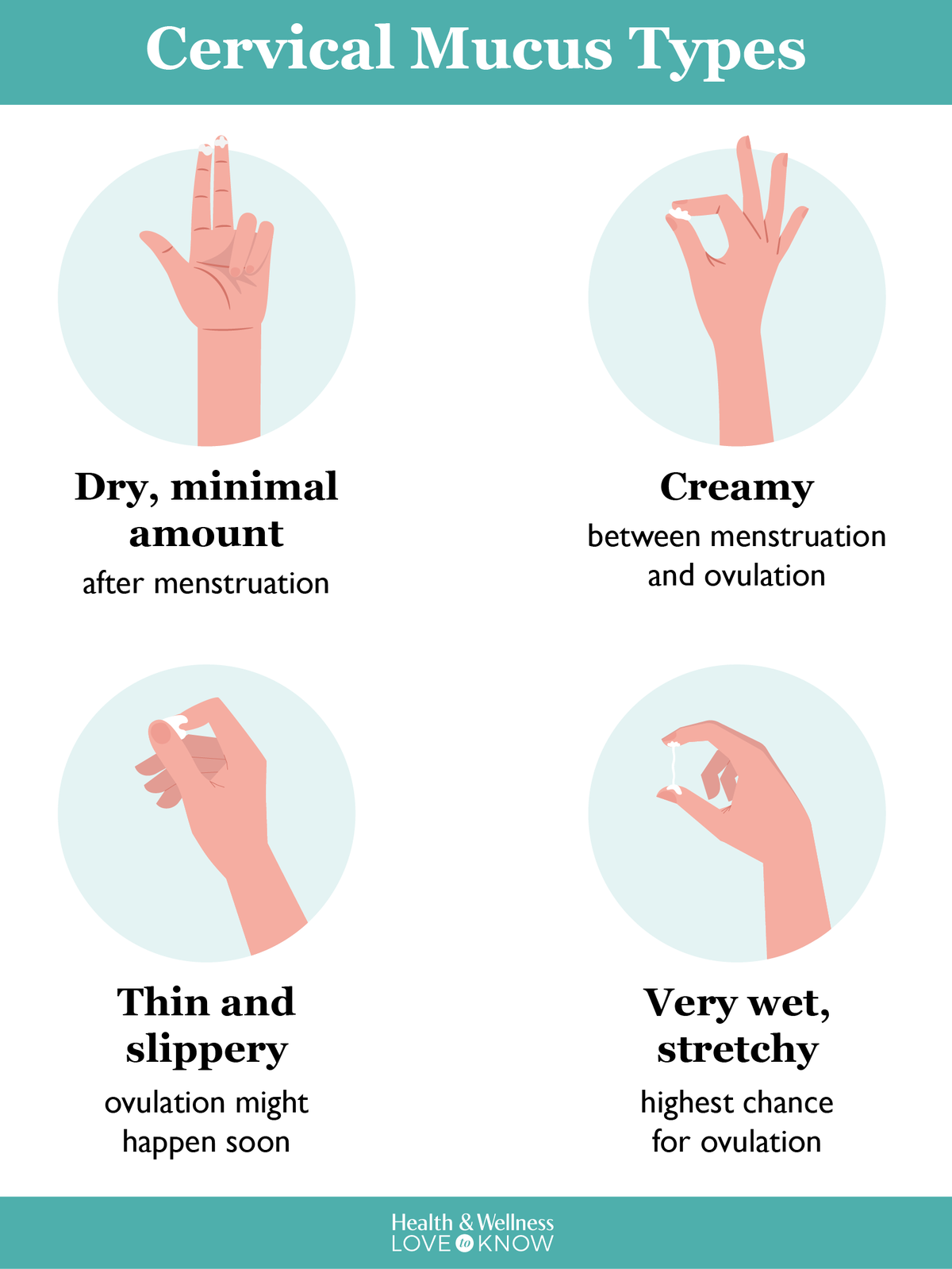 Cervical Mucus Types