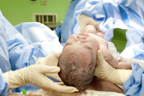 Episiotomy