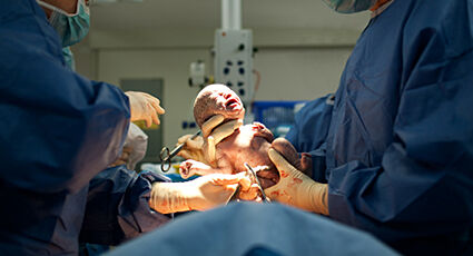 Image of a C-section birth in an operating room