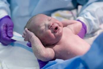 Newborn baby right after delivery