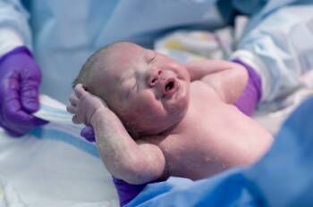 Newborn baby right after delivery