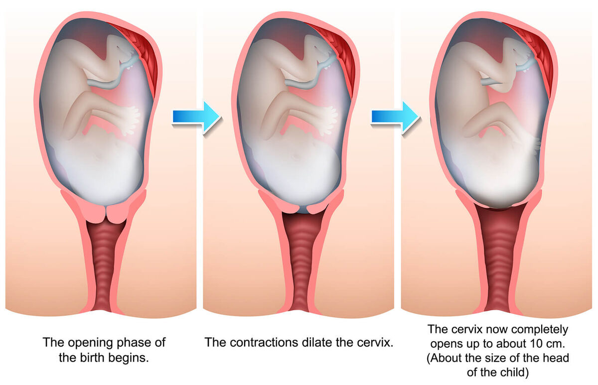 Stages of birth illustration