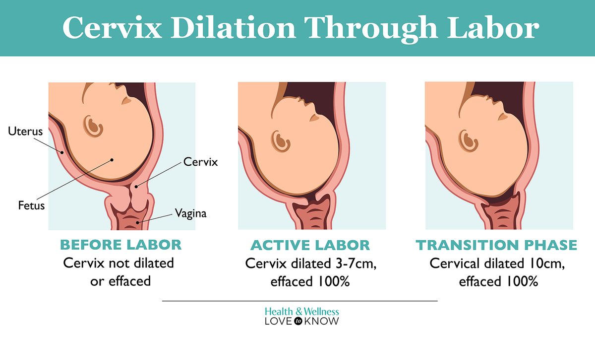 Cervix Dilation Through Labor