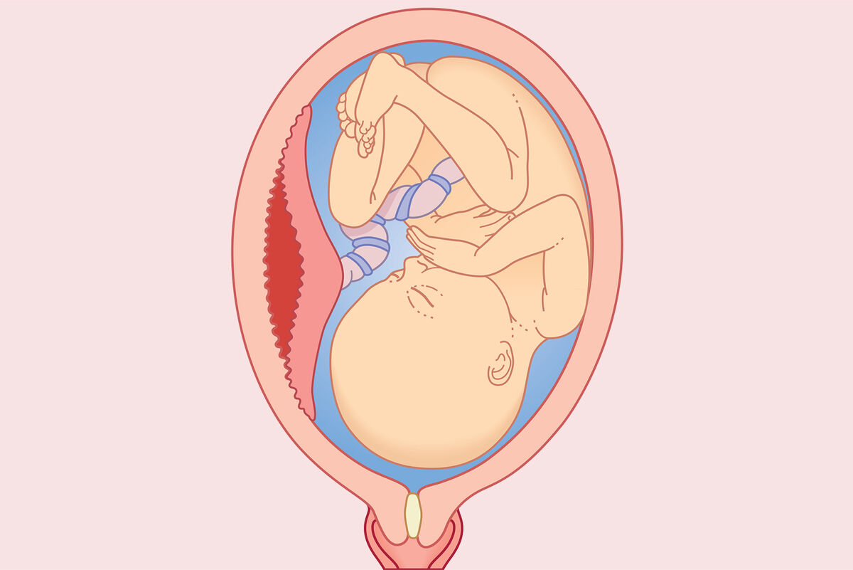 placental lining separated from uterus