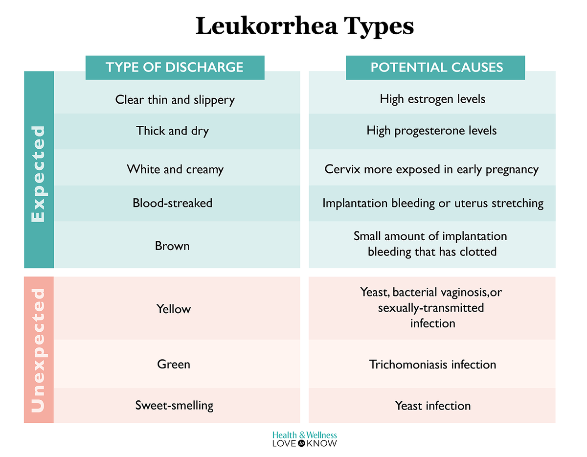 Leukorrhea types and their meaning infographic