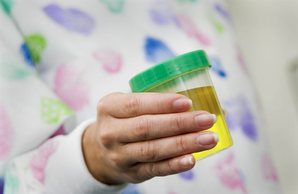 Urine specimen