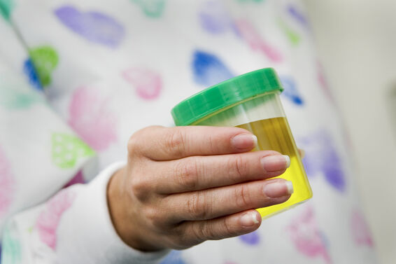 Urine specimen