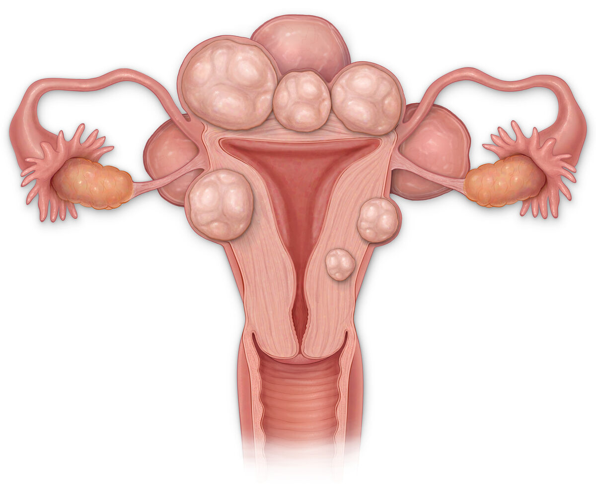 cross sectional view of a uterus