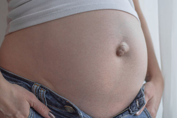 Umbilical hernia in a pregnant woman