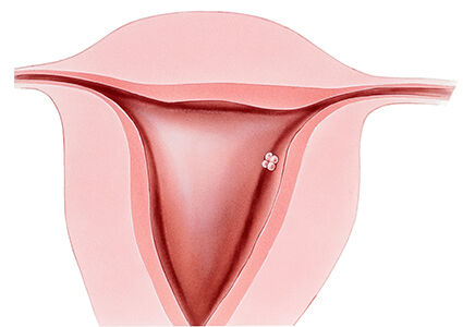 pregnancy week 4