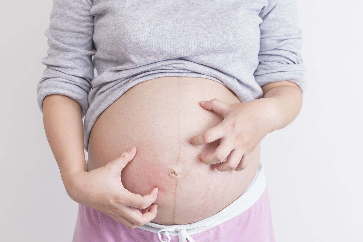Pregnant woman scratching her belly