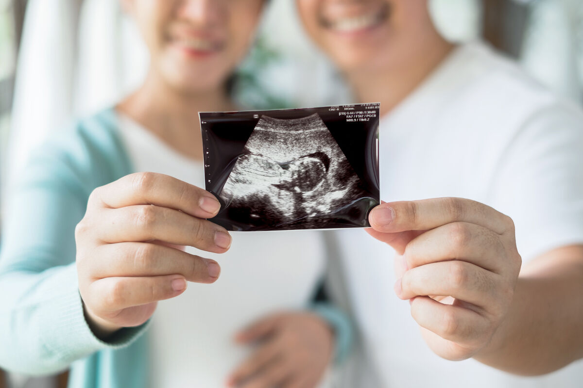 Pregnant couple feeling happy show ultrasound image