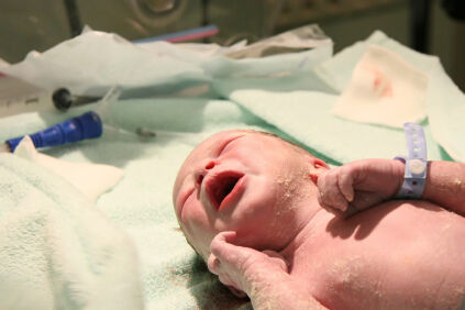 Image of a newborn baby in the delivery room
