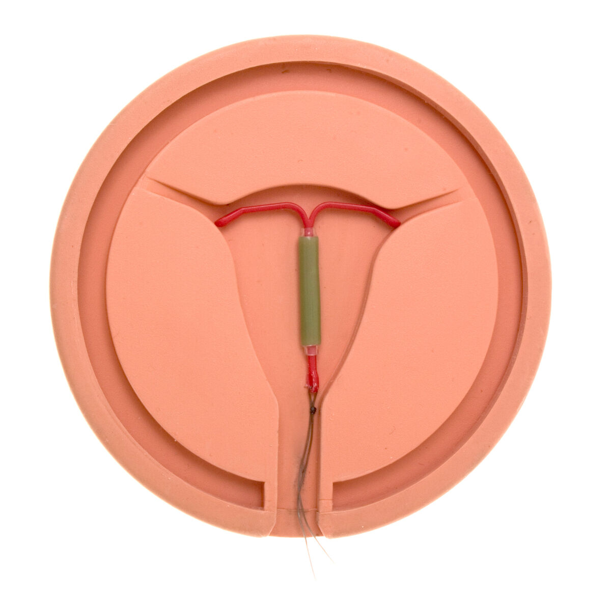 Image of an IUD