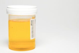 Urine sample