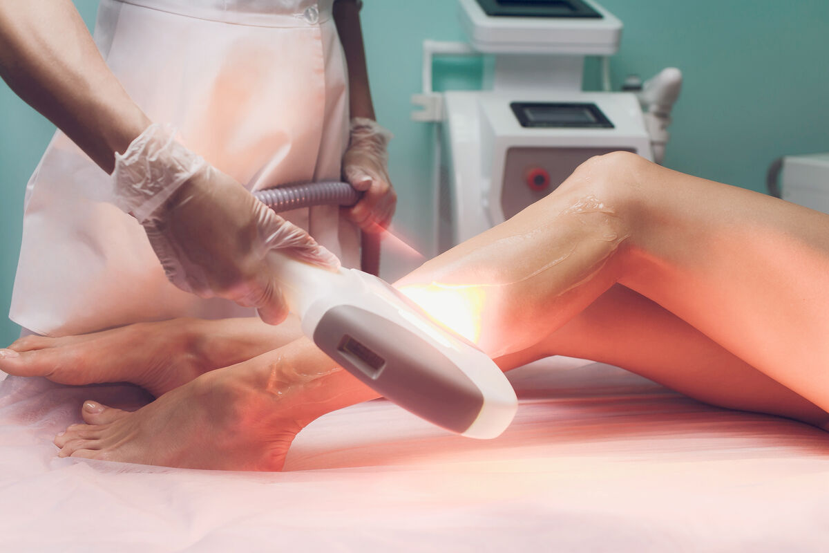 Beautician removes hair woman's legs using a IPL machine