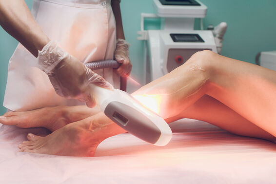 Beautician removes hair woman's legs using a IPL machine