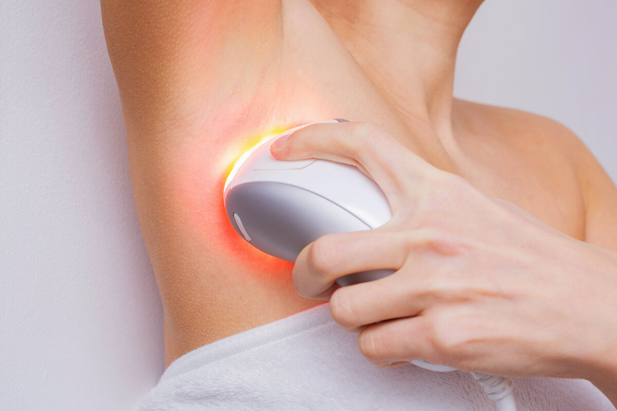Intense pulsed light or laser armpit depilation