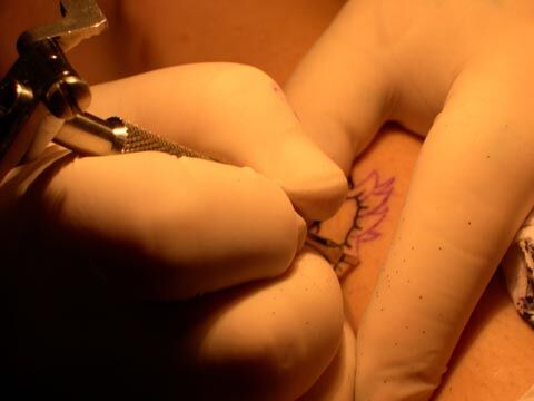 Tattooing