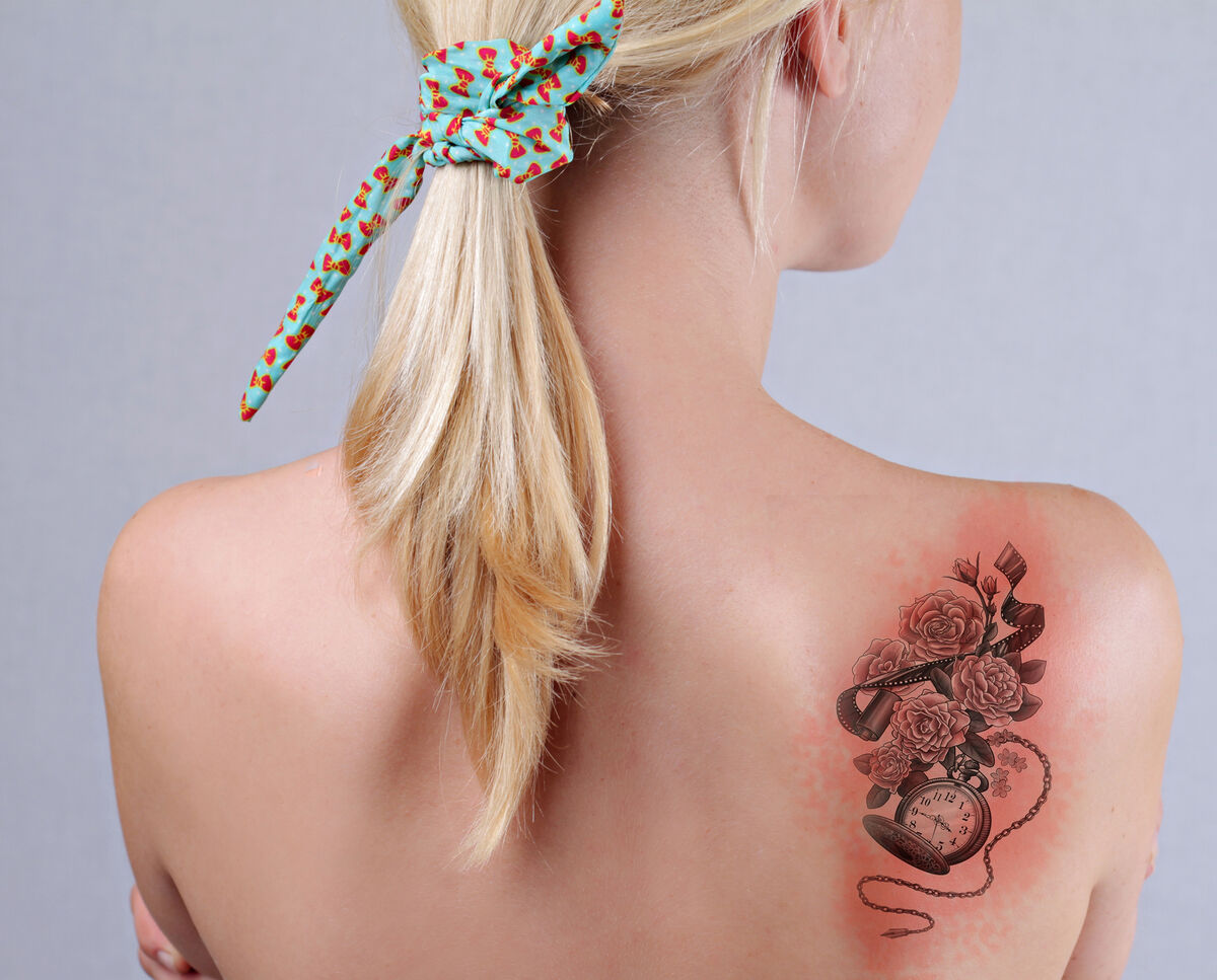 Infected tattoo