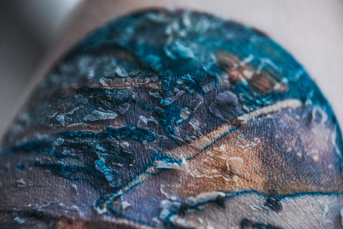 Tattoo in healing process