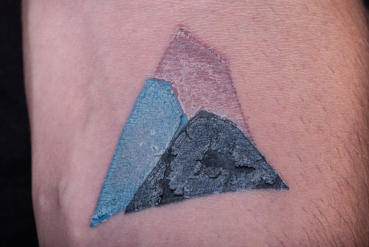 Thin flaky layer over tattoo