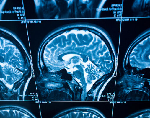 Head x-ray