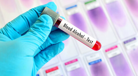 Alcohol test