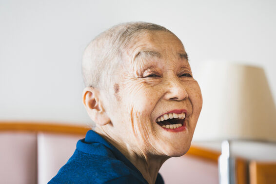Asian senior woman in her 80's whose hair is going bald
