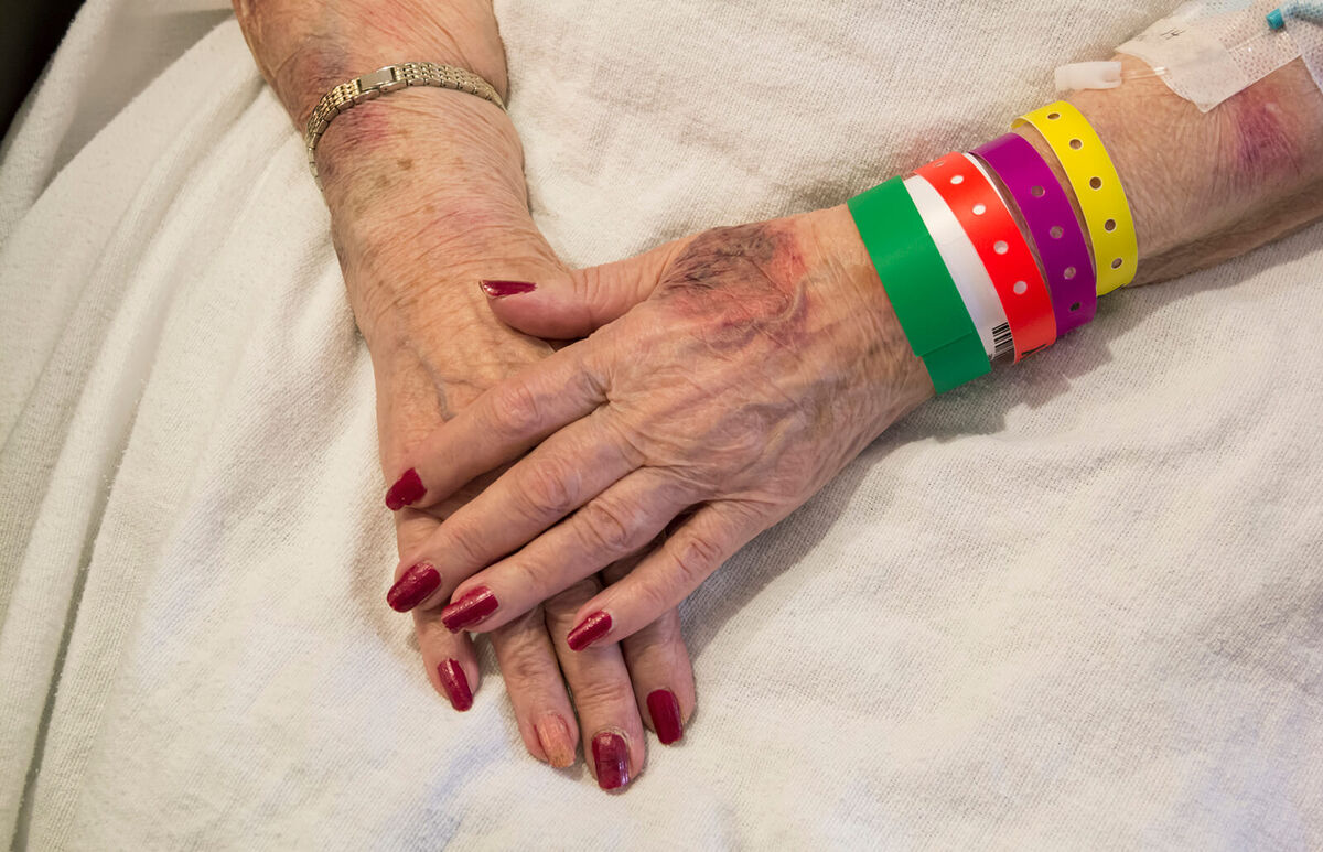 Bruised Hands of Elderly Woman in Emergency Room
