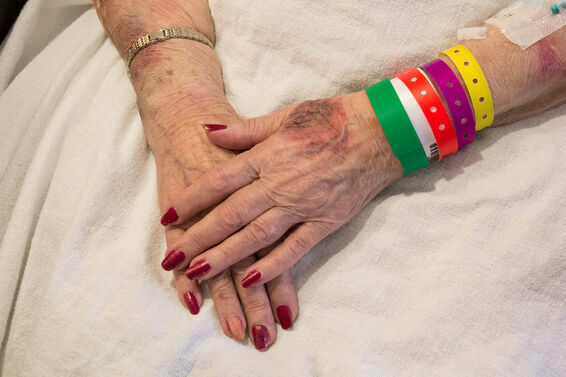 Bruised Hands of Elderly Woman in Emergency Room